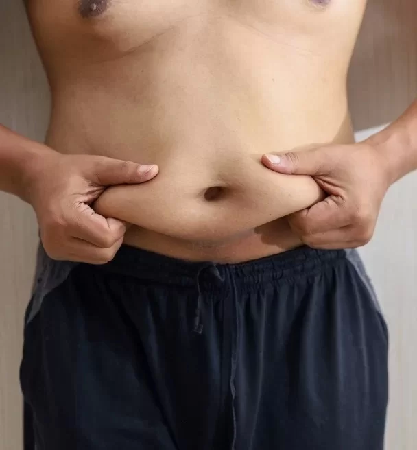 koilioplastiki-gia-andres